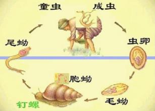 血吸虫病