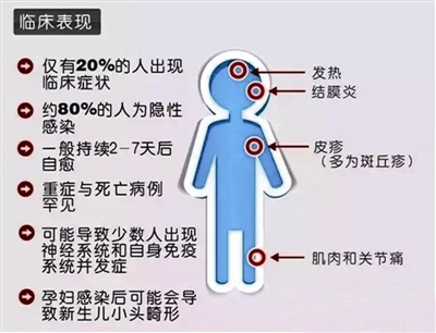 寨卡病毒