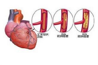 心脑血管对比